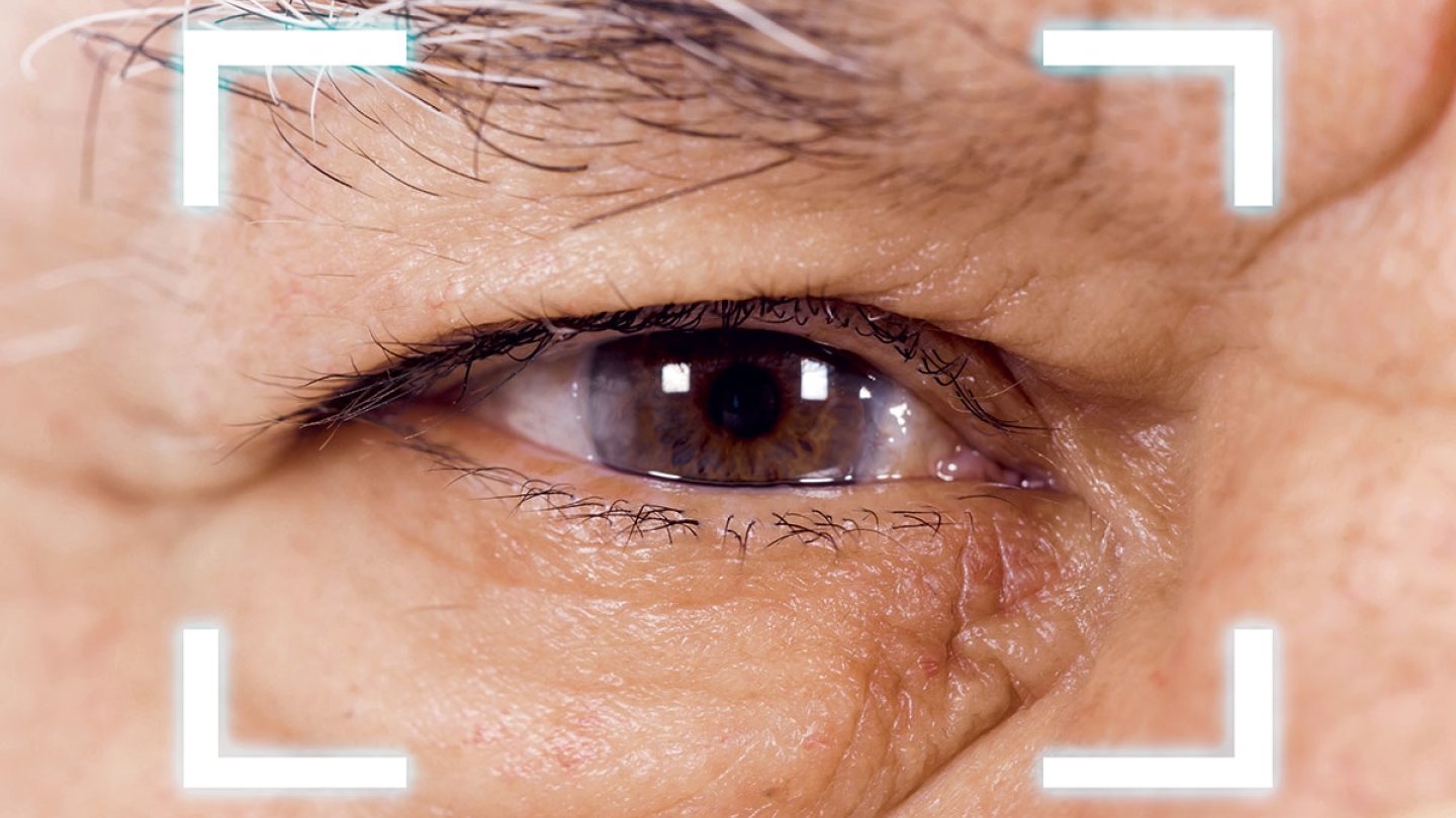 Cataracte santé vue oeil opération âge